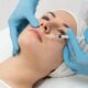 Dermal Filler Treatment
