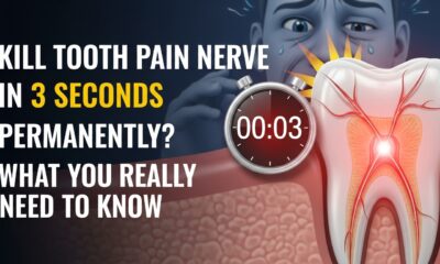 kill tooth pain nerve in 3 seconds permanently